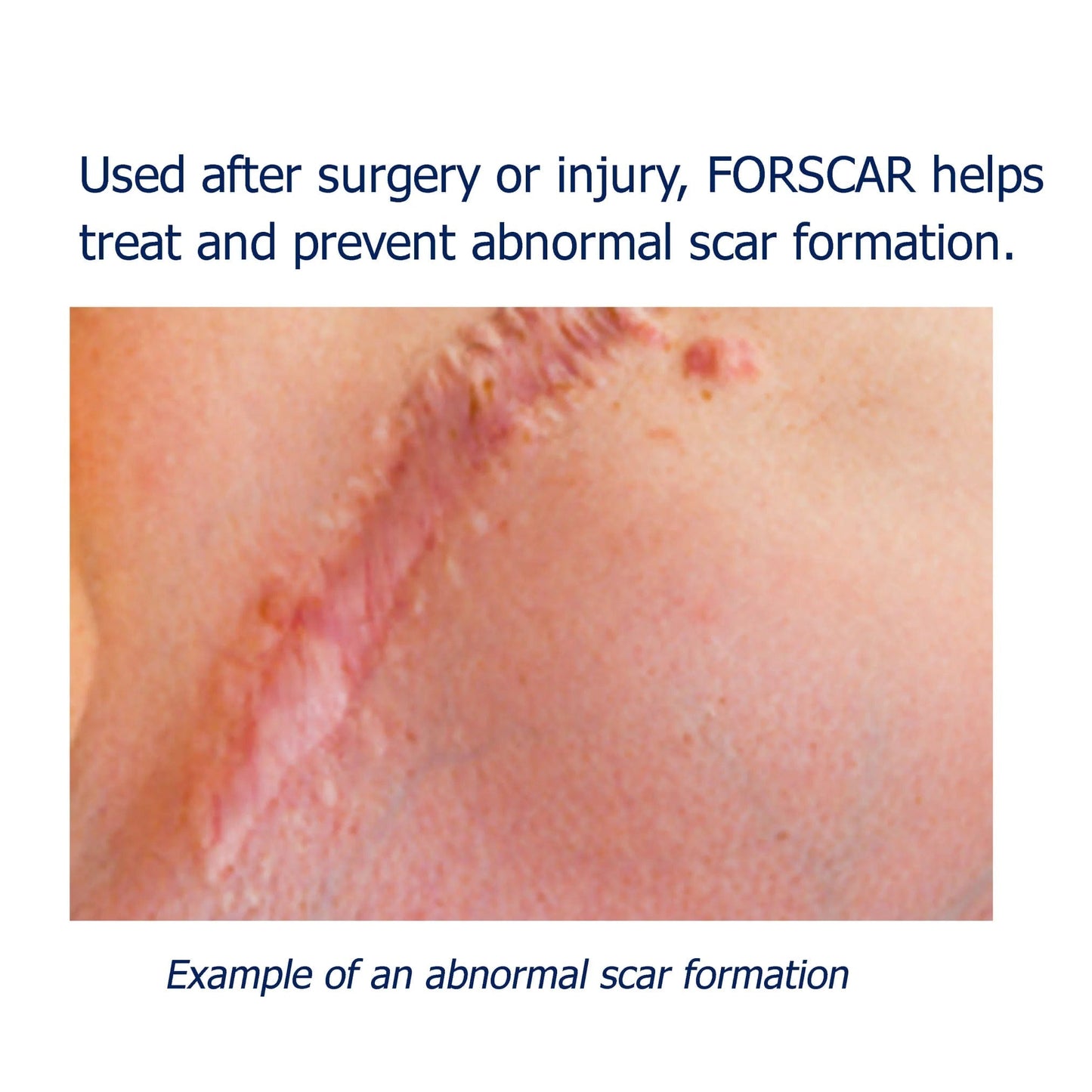 COSMETISTA Skin Care Forscar 10Ml// IMAGE