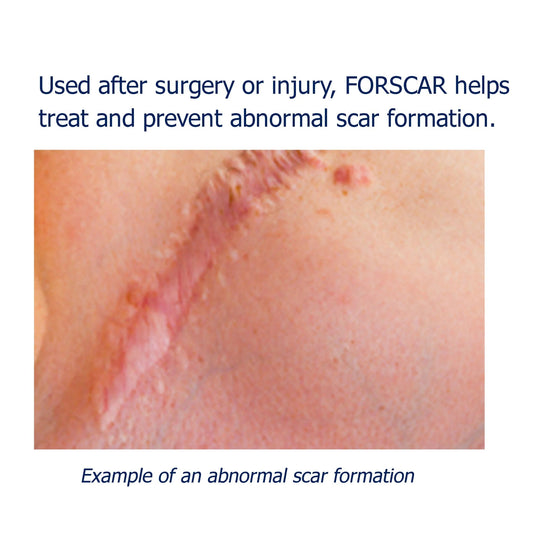COSMETISTA Skin Care Forscar 10Ml// IMAGE